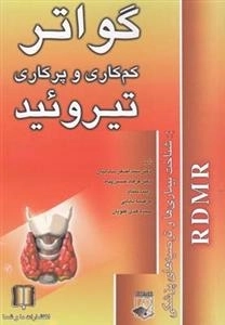 گواتر و تیروئید